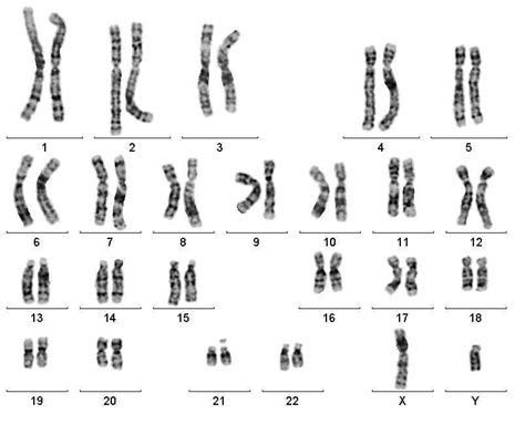 Karyotype Karyogram 차이점 : 지식iN