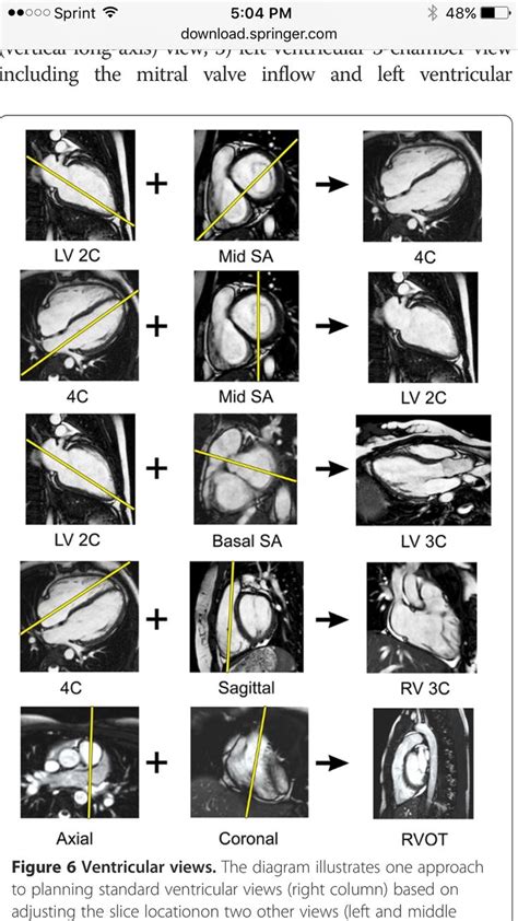 Cardiac MRI | Cardiac sonography, Radiology, Mri