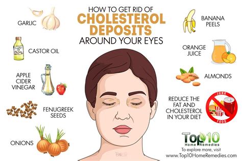 How To Remove Cholesterol Deposits On Eyelids At Home