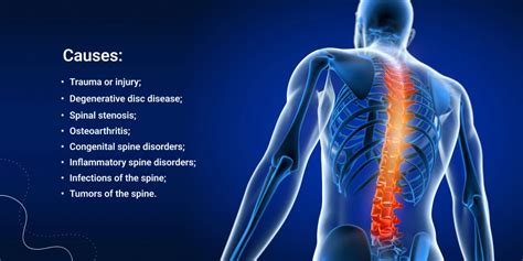 Spinal Cord Disorders: Symptoms, Causes and Treatment