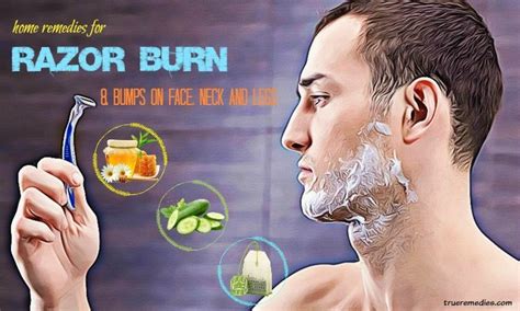 31 Home Remedies For Razor Burn & Bumps On Face, Neck, Legs