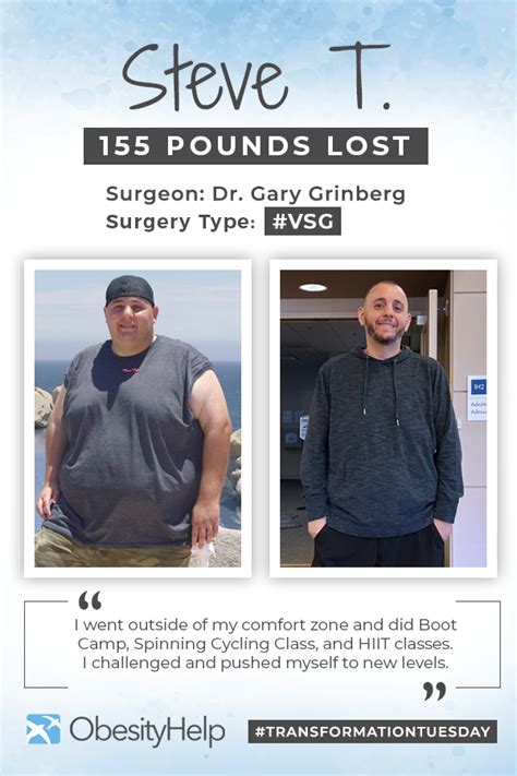 Before & After VSG with Steve T., down 155 pounds! : ObesityHelp