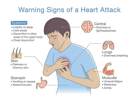 What are men's symptoms of a heart attack? Warning, Signs in Men