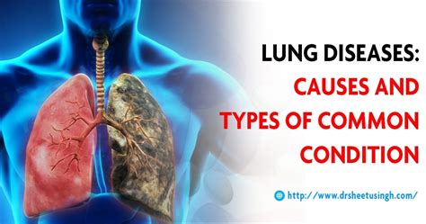 Lung Diseases: Types and Causes, Breathing Problem Symptoms & Risk