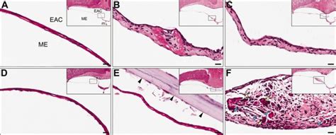 Photomicrographs of histological sections of (A) normal tympanic... | Download Scientific Diagram