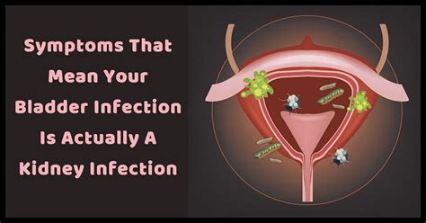 7 Important Symptoms That Mean Your Bladder Infection Is Actually A Kidney Infection