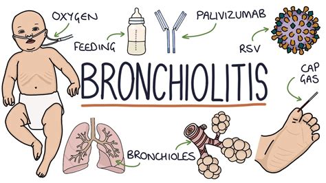 Understanding Bronchiolitis - YouTube