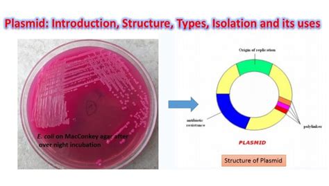 Plasmid: Introduction, Structure, Types, isolation and its uses