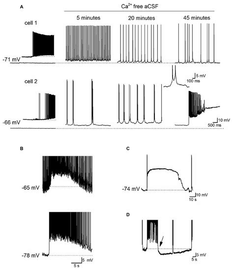 Frontiers | Reducing Extracellular Ca2+ Induces Adenosine Release via Equilibrative Nucleoside ...