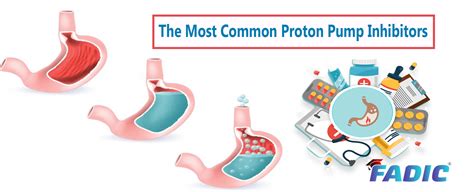 Proton Pump Inhibitors Common Types, Side Effects