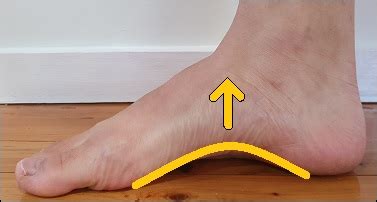 How To Fix High Arches In Feet - Posture Direct