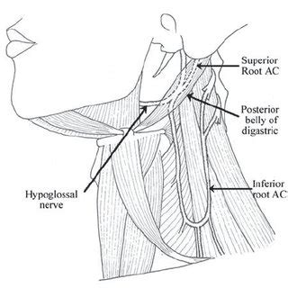 Superior root of the ansa cervicalis (AC) located below the posterior... | Download Scientific ...