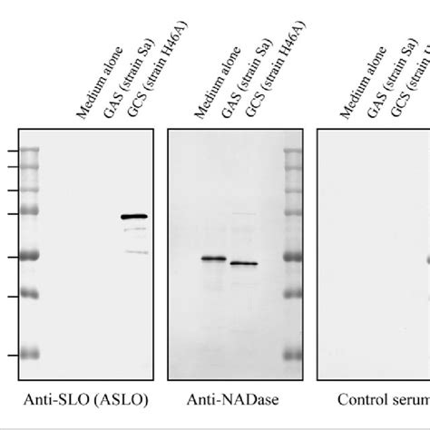 (PDF) Expression of Recombinant Streptolysin O and Specific Antibody Production