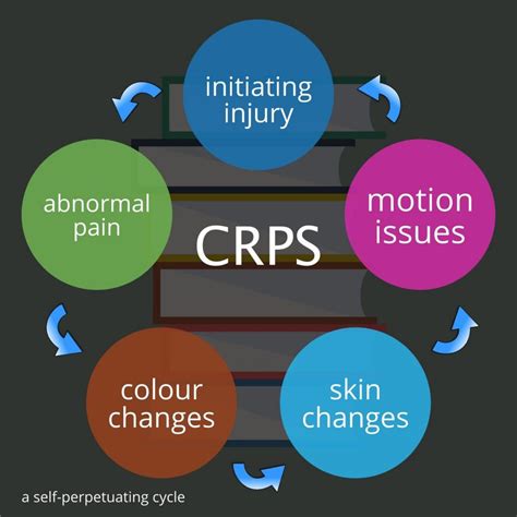 Complex Regional Pain Syndrome (CRPS) - Port Melbourne Physiotherapy & Pilates!