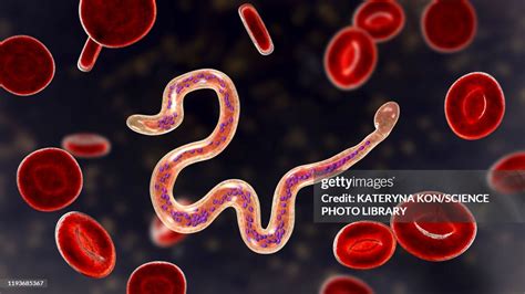 Brugia Malayi Parasitic Worm Illustration High-Res Vector Graphic ...