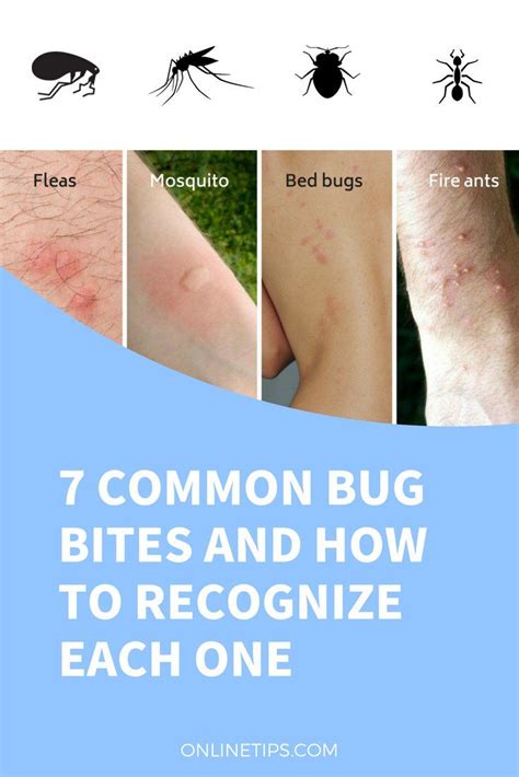 Types Of Mosquito Bites Pictures | PeepsBurgh.Com