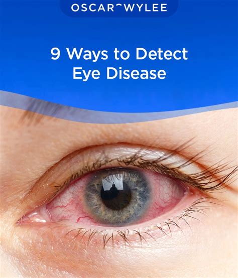 9 Ways to Detect Eye Disease