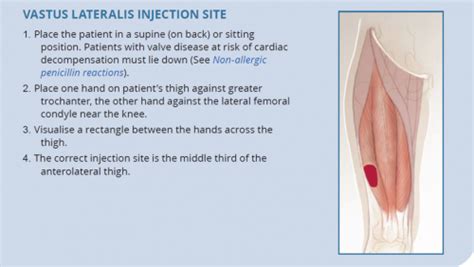 Clinical Update - Secondary Prevention of ARF | Rheumatic Heart Disease ...