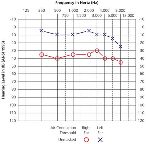 Pure tone audiometry, pure tone audiometry test