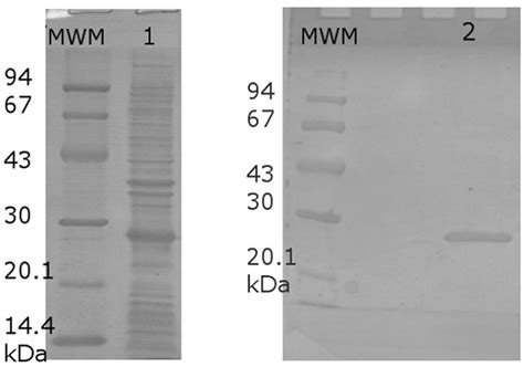 Tail tubular protein A: a dual-function tail protein of Klebsiella pneumoniae bacteriophage KP32 ...
