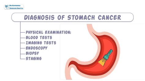 Stomach Cancer - Dr. Kapendra Shekhar Amatya