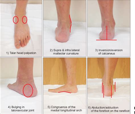 Foot Posture Index Score Sheet