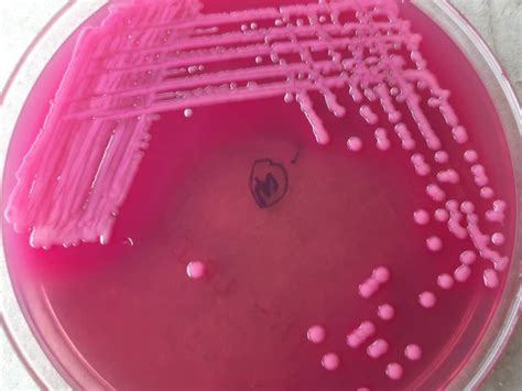 Klebsiella pneumoniae UTI treatment – KNOW & TREAT UTI