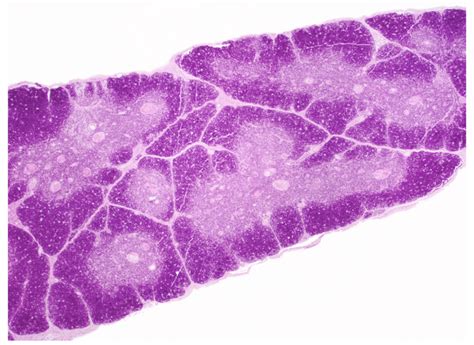 Lymphatic thymus gland histology Diagram | Quizlet