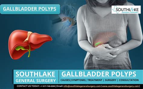 Gallbladder Polyps – Causes, Symptoms & Treatment - Southlake General Surgery