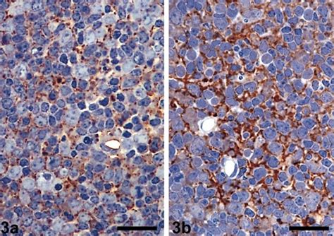 Prions: Diseases and Treatment - Serious Science