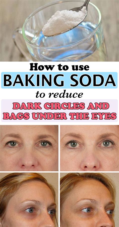 How To Use Baking Soda To Reduce Dark Circles And Bags Under The Eyes ...