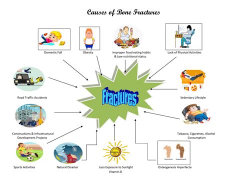 Causes of Bone Fractures | Quicfrac Blogs