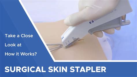 MIRUS Skin Staplers: Surgical Skin Staplers Meril Life | atelier-yuwa.ciao.jp