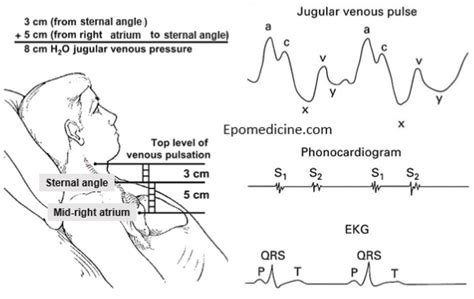 Inspection Of Neck Veins Semantic Scholar, 59% OFF