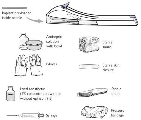 Subdermal Implant Birth Control