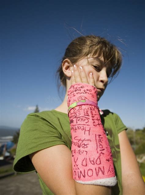 Child with Arm in Plaster Cast Stock Photo - Image of plaster ...