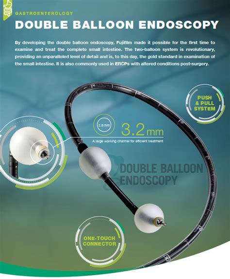 Double Balloon Endoscopy DBE