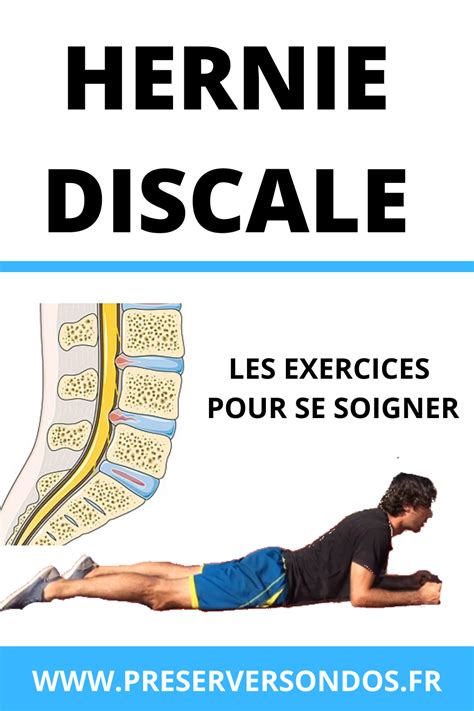 Hernie discale : les exercices pour se soigner | Hernie discale ...