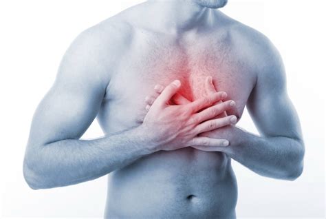 Substernal Chest Pain - Diagnosis, Symptoms, Treatment