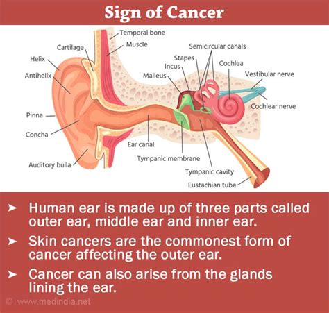 Cancers of the Ear / Ear Cancers Causes, Symptoms, Diagnosis, Treatment ...