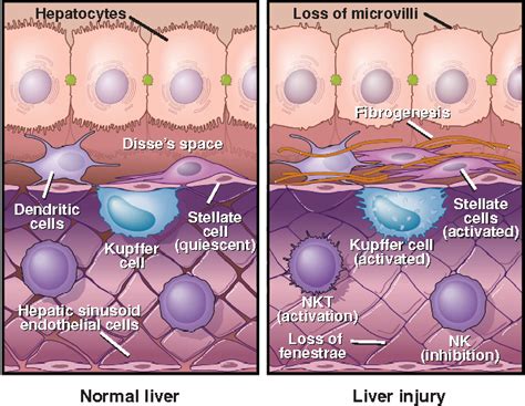 Evaluating Liver Test Abnormalities: The Normal Liver