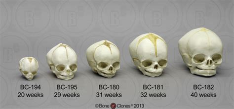 Bone Clones Human Skull & Skeleton Casts