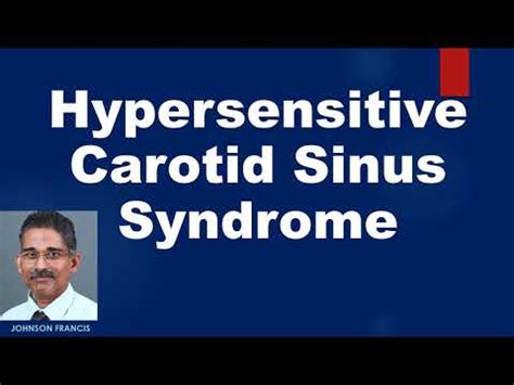 Hypersensitive Carotid Sinus Syndrome - YouTube