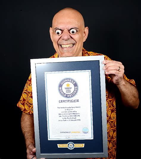 Man breaks Guinness World Record for farthest eyeball pop - News and Gossip