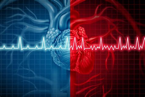 Aritmie cardiache: la fibrillazione atriale - Emergency Live
