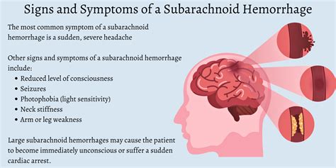 What is a Subarachnoid Hemorrhage (SAH)?