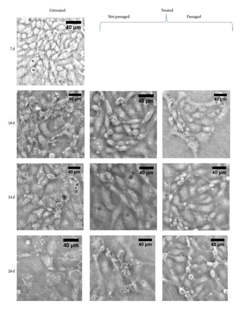 Image comparison during Plasmocin treatment. This series of images... | Download Scientific Diagram