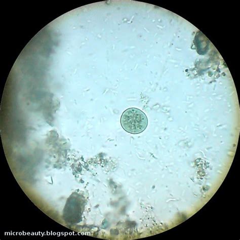 The Wonderful Microworld: Microorganisms in water.