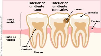 Mantener la dentadura de su hijo sana (para Padres) - Rady Children's Hospital - San Diego