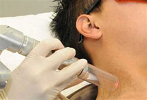 Laser Birthmark Removal Pune | Birthmark Laser Treatment